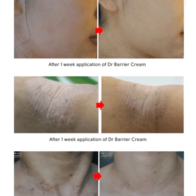 bbbarrier001-2.webp bbbarrier001-2.webp