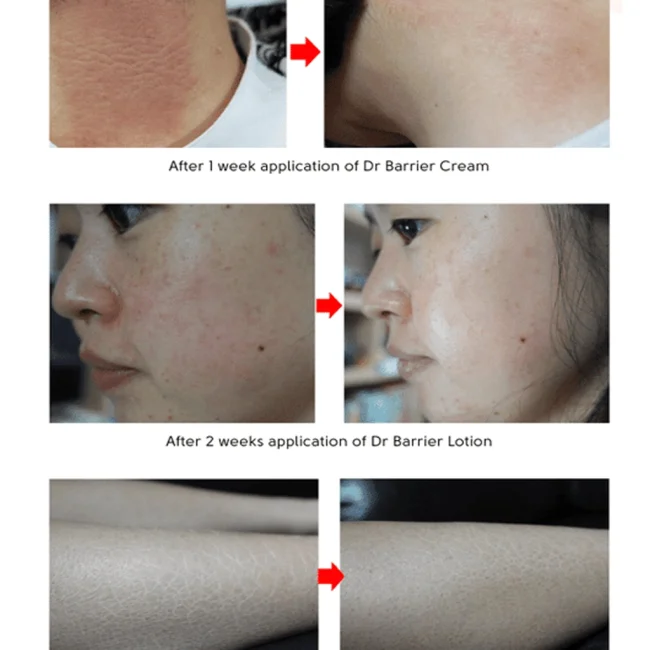 bbbarrier001-3.webp bbbarrier001-3.webp